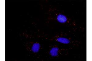 Proximity Ligation Analysis of protein-protein interactions between CALR and B2M.