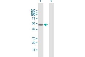 Western Blot analysis of MAGEA8 expression in transfected 293T cell line by MAGEA8 MaxPab polyclonal antibody. (MAGEA8 anticorps  (AA 1-318))