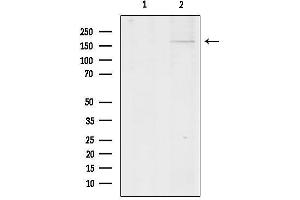 Western blot analysis of lysates from HepG2, using Collagen XIalpha 1 Antibody.