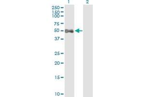 Western Blot analysis of ALDH9A1 expression in transfected 293T cell line by ALDH9A1 monoclonal antibody (M01), clone 3C6.