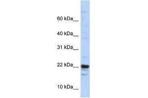 WB Suggested Anti-KIAA0040 Antibody Titration:  0.