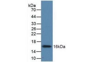 Western blot analysis of recombinant Human UGCG. (UGCG anticorps  (AA 39-171))