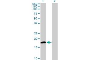 Western Blot analysis of DUSP21 expression in transfected 293T cell line by DUSP21 MaxPab polyclonal antibody. (DUSP21 anticorps  (AA 1-190))
