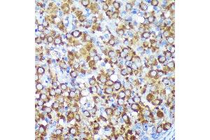 Immunohistochemistry of paraffin-embedded Rat ovary using CYB5R1 Rabbit pAb (ABIN7266630) at dilution of 1:100 (40x lens).