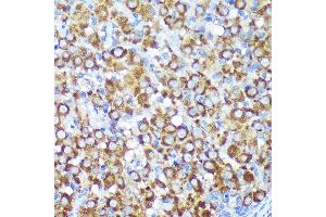 Immunohistochemistry of paraffin-embedded Rat ovary using CYB5R1 Rabbit pAb (ABIN7266630) at dilution of 1:100 (40x lens). (CYB5R1 anticorps  (AA 1-305))