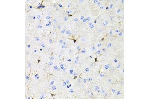 Immunohistochemistry of paraffin-embedded mouse brain using A antibody (ABIN3015791, ABIN3015792, ABIN3015793 and ABIN6219141) at dilution of 1:100 (40x lens).