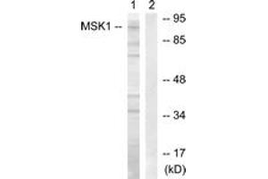 Western blot analysis of extracts from COS7 cells, treated with Sorbitol 0. (MSK1 anticorps  (AA 331-380))