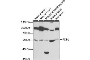 Western blot analysis of extracts of various cell lines, using PDP1 antibody (ABIN6132860, ABIN6145404, ABIN6145405 and ABIN6221944) at 1:1000 dilution. (PDP anticorps  (AA 278-537))