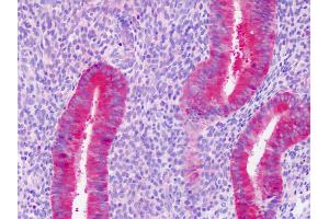 Anti-PAICS / ADE2 antibody IHC staining of human uterus, endometrium. (PAICS anticorps)