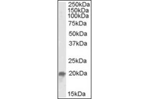 Image no. 2 for anti-Ubiquitin-Conjugating Enzyme E2F (UBE2F) (C-Term) antibody (ABIN375151) (UBE2F anticorps  (C-Term))