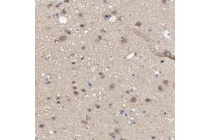 Immunohistochemical staining of human cerebral cortex with DYNLT3 polyclonal antibody  shows moderate cytoplasmic positivity in neuronal cells, glial cells.