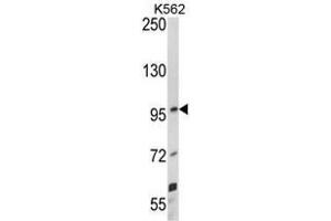 Western blot analysis of UNC5C Antibody (Center) in K562 cell line lysates (35ug/lane).