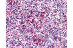 Immunohistochemistry (IHC) image for anti-PR Domain Containing 1, with ZNF Domain (PRDM1) (Middle Region) antibody (ABIN2792524)