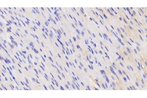 Detection of VCL in Human Cardiac Muscle Tissue using Anti-Vinculin (VCL) Polyclonal Antibody (Vinculin anticorps  (AA 1020-1134))