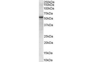 ABIN185431 (0. (VPS45 anticorps  (Internal Region))