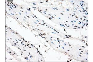 Image no. 13 for anti-Crystallin, alpha B (CRYAB) antibody (ABIN1497647)