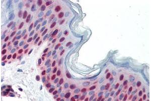 Human Skin (formalin-fixed, paraffin-embedded) stained with PAX7 antibody ABIN462176 followed by biotinylated goat anti-rabbit IgG secondary antibody ABIN481713, alkaline phosphatase-streptavidin and chromogen.