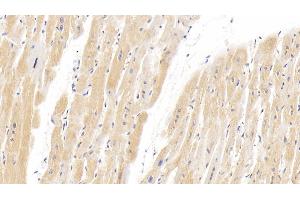 Detection of HIF2a in Human Cardiac Muscle Tissue using Polyclonal Antibody to Hypoxia Inducible Factor 2 Alpha (HIF2a) (EPAS1 anticorps  (AA 26-347))