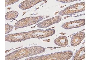 IHC analysis of DAZAP1 using anti-DAZAP1 antibody (ABIN6719309). (DAZAP1 anticorps  (AA 1-189))