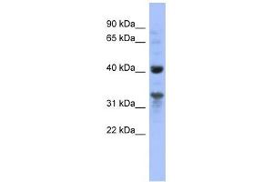 MRPL37 antibody used at 1 ug/ml to detect target protein. (MRPL37 anticorps  (N-Term))