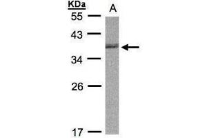 WB Image Sample (30μg whole cell lysate) A:Raji , 12% SDS PAGE antibody diluted at 1:1000 (CDC34 anticorps)