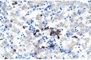 Human kidney; ABT1 antibody - middle region in Human kidney cells using Immunohistochemistry (Activator of Basal Transcription 1 anticorps  (Middle Region))