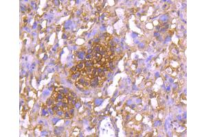 Paraformaldehyde-fixed, paraffin embedded mouse placenta section, Antigen retrieval by boiling in sodium citrate buffer (pH6.