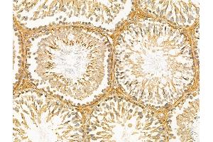 ABIN6260964 and ABIN6268886 at 1/100 staining Rat testis tissue by IHC-P.