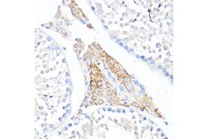 Immunohistochemistry of paraffin-embedded mouse testis leydig using Fibronectin antibody (ABIN7267194) at dilution of 1:100 (40x lens). (Fibronectin 1 anticorps  (AA 2200-2355))