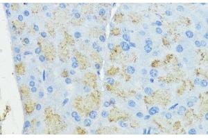 Immunohistochemistry of paraffin-embedded Mouse pancreas using SOD3 Polyclonal Antibody at dilution of 1:100 (40x lens). (SOD3 anticorps)