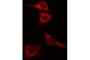 ABIN6274987 staining COLO205 cells by IF/ICC. (CEP135 anticorps  (C-Term))