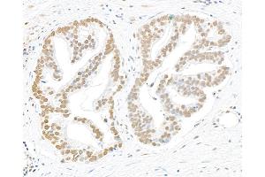 Immunohistochemistry (IHC) image for anti-Replication Protein A2, 32kDa (RPA2) (pSer4), (pSer8) antibody (ABIN7449013) (RPA2 anticorps  (pSer4, pSer8))