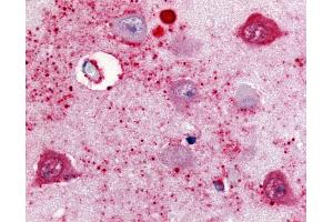 Anti-SSTR2 antibody IHC of human brain, subiculum neurons.