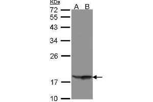 WB Image Sample(30 μg of whole cell lysate) A:Raji, B:MOLT4, 12% SDS PAGE antibody diluted at 1:1000 (RARRES3 anticorps  (C-Term))