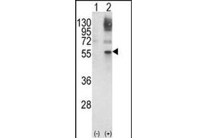 Western blot analysis of GATA2 (arrow) using rabbit polyclonal GATA2 Antibody (Center) (ABIN652243 and ABIN2841006). (GATA2 anticorps  (AA 262-288))