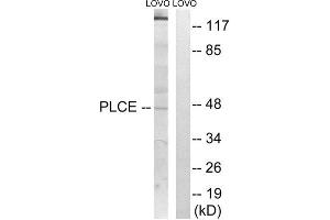Western Blotting (WB) image for anti-1-Acylglycerol-3-Phosphate O-Acyltransferase 5 (Lysophosphatidic Acid Acyltransferase, Epsilon) (AGPAT5) (Internal Region) antibody (ABIN1850516) (AGPAT5 anticorps  (Internal Region))