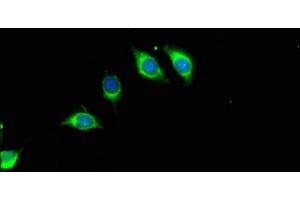 Immunofluorescent analysis of A549 cells using ABIN7168091 at dilution of 1:100 and Alexa Fluor 488-congugated AffiniPure Goat Anti-Rabbit IgG(H+L)