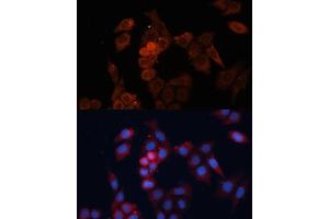 Immunofluorescence analysis of HeLa cells using HSP27/HSP27/HSPB1 antibody (ABIN7267568) at dilution of 1:100. (HSP27 anticorps  (AA 1-120))