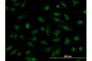 Image no. 2 for anti-Nucleoporin 133kDa (NUP133) (AA 1069-1156) antibody (ABIN599269)