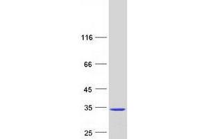 Validation with Western Blot