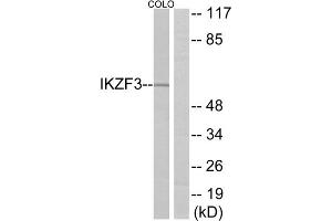 Western blot analysis of extracts from COLO cells, using IKZF3 antibody. (IKZF3 anticorps  (Internal Region))