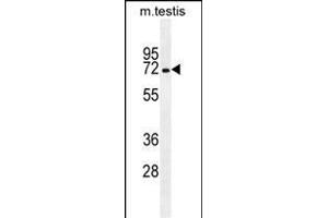 MBTD1 Antibody (C-term) (ABIN655319 and ABIN2844896) western blot analysis in mouse testis tissue lysates (35 μg/lane).