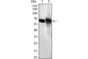 Western blot analysis using ALPI mouse mAb against HL60 (1) and HepG2 (2) cell lysate. (Intestinal Alkaline Phosphatase anticorps  (AA 397-458))