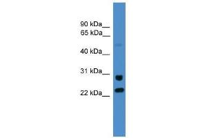 KIAA0152 antibody used at 0. (Malectin anticorps  (C-Term))