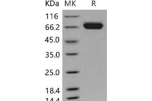 Western Blotting (WB) image for EPH Receptor A7 (EPHA7) (Active) protein (His tag) (ABIN7195537)