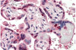 Human Placenta (formalin-fixed, paraffin-embedded) stained with DDB1 antibody ABIN396934 at 5 ug/ml followed by biotinylated anti-mouse IgG secondary antibody ABIN481714, alkaline phosphatase-streptavidin and chromogen. (DDB1 anticorps)