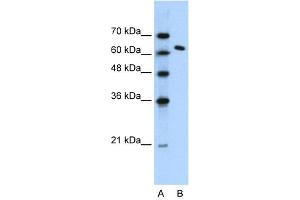 WB Suggested Anti-SUPT16H Antibody Titration: 1. (SUPT16H anticorps  (N-Term))