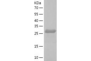 Western Blotting (WB) image for DnaJ (Hsp40) Homolog, Subfamily C, Member 27 (DNAJC27) (AA 1-273) protein (His-IF2DI Tag) (ABIN7122699)