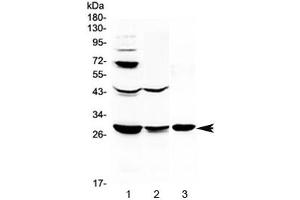 Western blot testing of 1) rat liver, 2) rat kidney and 3) mouse kidney lysate with TL1A antibody at 0. (TNFSF15 anticorps)