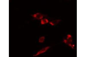ABIN6274466 staining HuvEc cells by IF/ICC. (MKL1 anticorps  (N-Term))